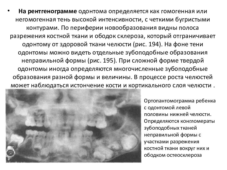 Доброкачественные одонтогенные опухоли челюстей презентация