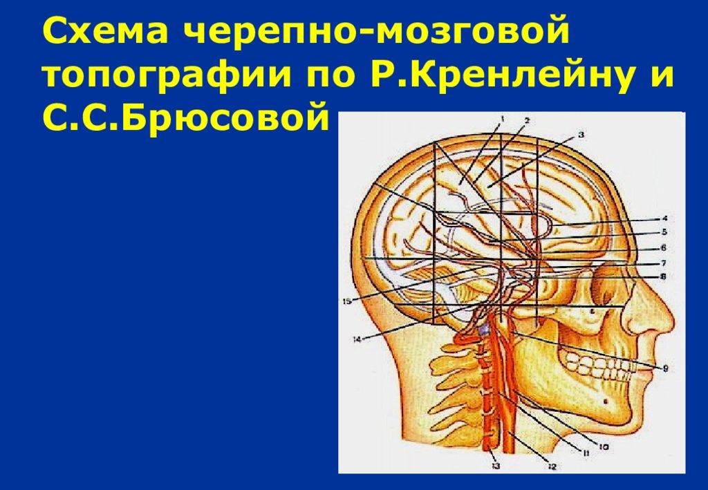 Схема служащая для ориентировки в черепно мозговой топографии