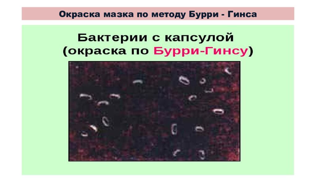 Метод бурри гинса. Метод по Бурри ГИНСУ микробиология. Капсулы Klebsiella pneumoniae. Окраска по Бурри-ГИНСУ. Бурри ГИНСУ микробиология окраска. Капсула бактерий окраска по Бурри-ГИНСУ.