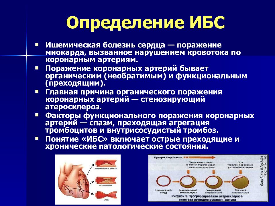 Презентация ишемия сердца