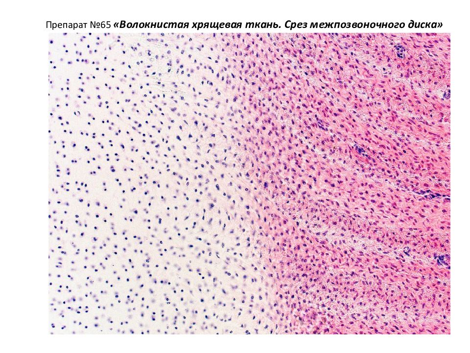 Препараты тканей. Волокнистый хрящ гистология. Волокнистый хрящ препарат гистология. Волокнистая хрящевая ткань гистология. Волокнистая хрящевая ткань препарат.