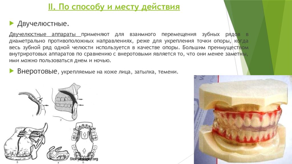 Классификация ортодонтических аппаратов презентация