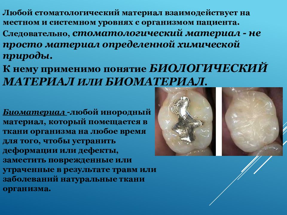 Принципы контроля качества стоматологических материалов