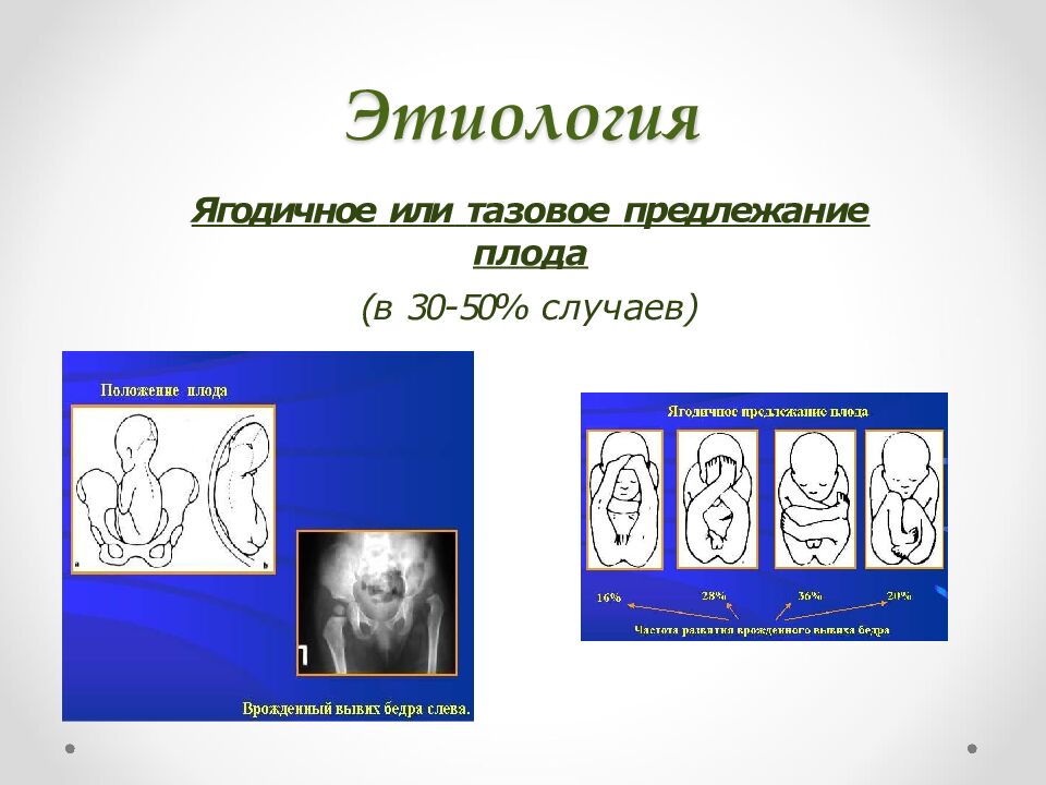 Этиология