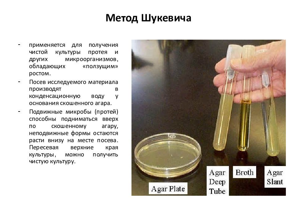 Используется для получения. Метод который используется для посева. Методы выделения чистых культур (метод обогащения) картинки. Метод Гукевича и Мечникова.