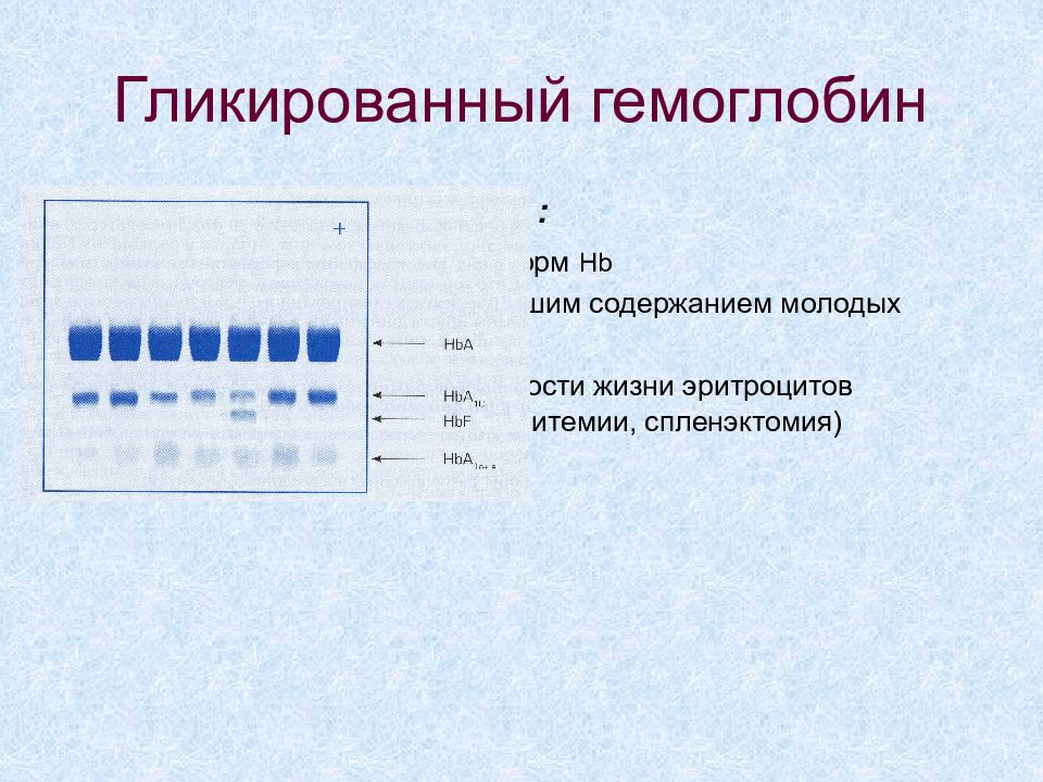 Гликированный гемоглобин. Электрофорез гликированного гемоглобина.