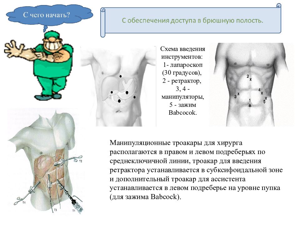 Грыжи презентация хирургические болезни