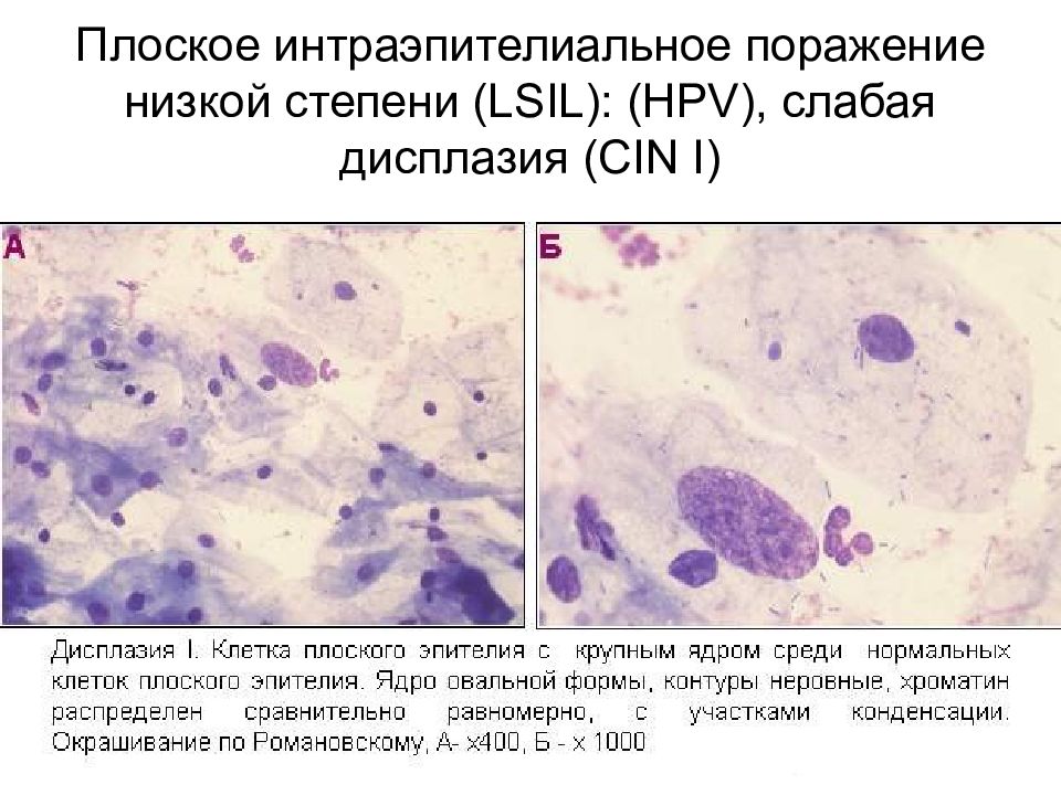 Цитологическая диагностика заболеваний шейки матки презентация