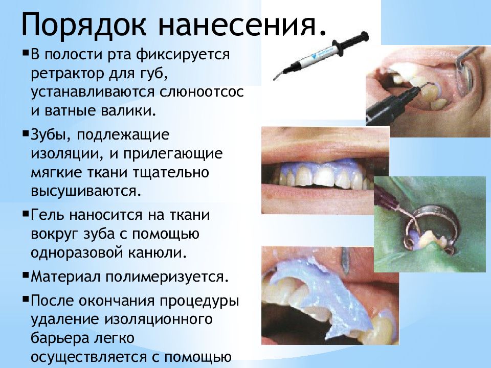 Цвет в стоматологии презентация