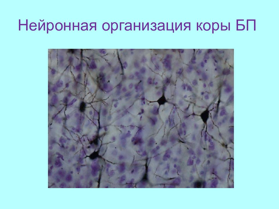 По изображению с микроскопа в препарате коры больших полушарий импрегнированном нитратом серебра