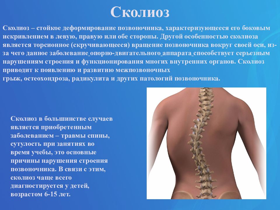 Заболевания опорно-двигательного аппарата презентация. Заболевания опорно-двигательного аппарата список. Нарушение опорно-двигательного аппарата. Симптомы заболеваний опорно-двигательного аппарата.