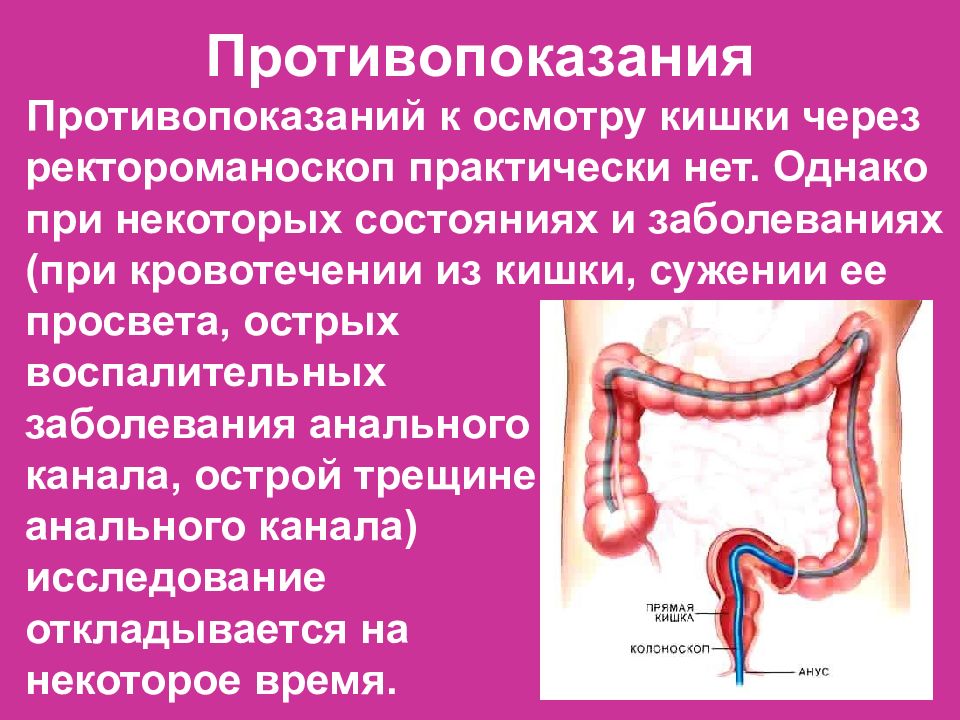 Заболевания прямой кишки хирургия презентация