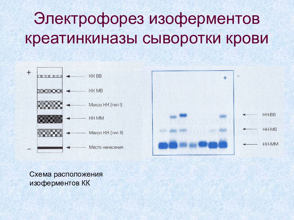 Электрофорез белков. Электрофорез белков крови. Электрофорез белков сыворотки крови. Электрофорез схема.