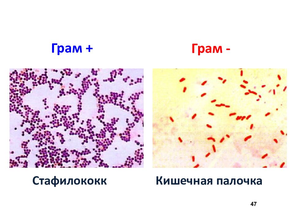 Рисунок мазка стафилококка