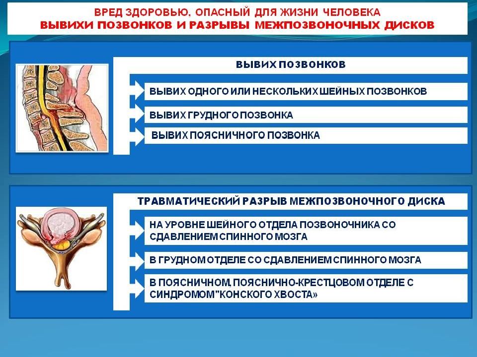 Вред здоровью является. Опасность для жизни тяжкий вред здоровью. Опасный для жизни вред здоровью. Вред опасный для жизни это. Экспертиза вред здоровью.