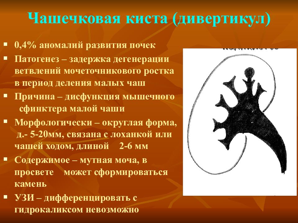 Киста почки мкб 10. Дивертикул чашечки почки. Чашечковый дивертикул.