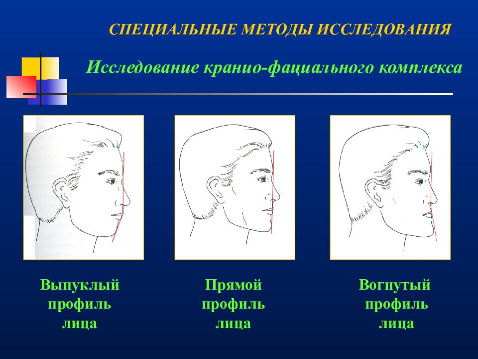 Тип контура. Типы профилей лица. Тип профиля лица ортодонтия. Прямой профиль лица ортодонтия. Типы профиля ортодонтия.