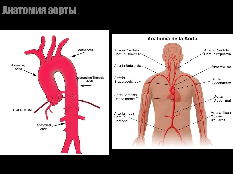 Анатомия аорты. Синдром компрессионного стеноза чревного ствола. Аорта анатомия.