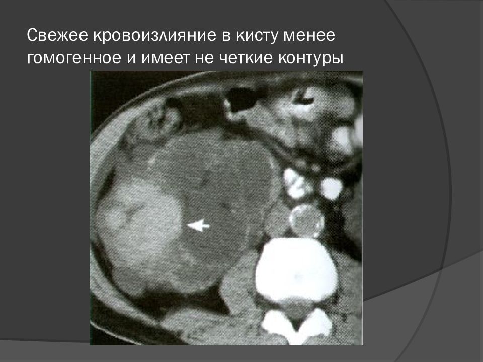 Почему Фотографии Не Четкие