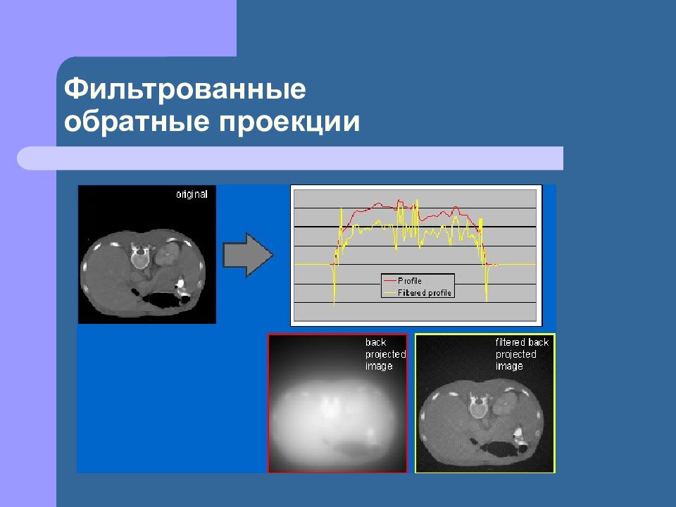 Коды услуг компьютерная томография. Фильтрованная Обратная проекция. Рентгеновская компьютерная томография алгоритм. Обратное проецирование томография. Томография метод обратной проекции.