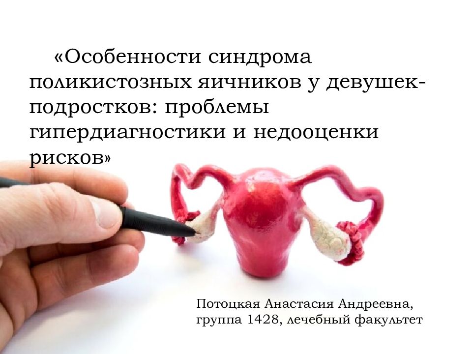 « Особенности синдрома поликистозных яичников у девушек-подростков: проблемы