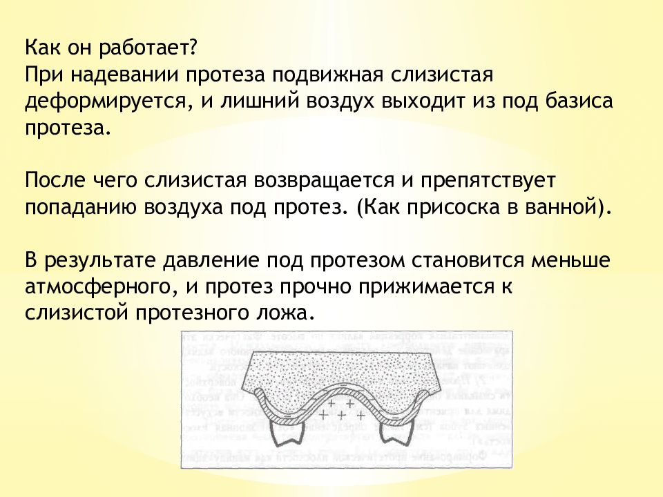 Пластмассы в ортопедической стоматологии. Пористость сжатия пластмассы. Моделировка базиса протеза. Гранулярная пористость протеза. Пористость протезов.