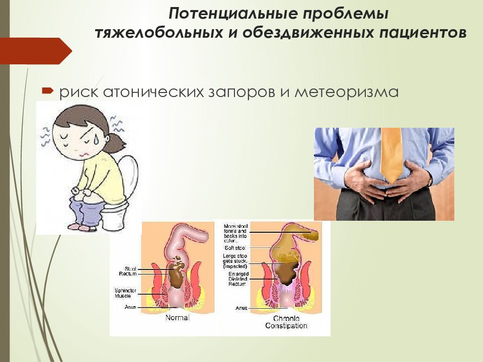 План ухода при запоре