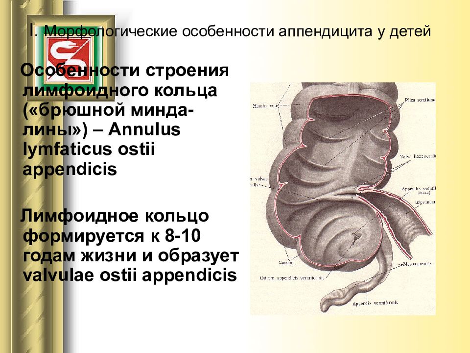 Острый аппендицит у детей презентация