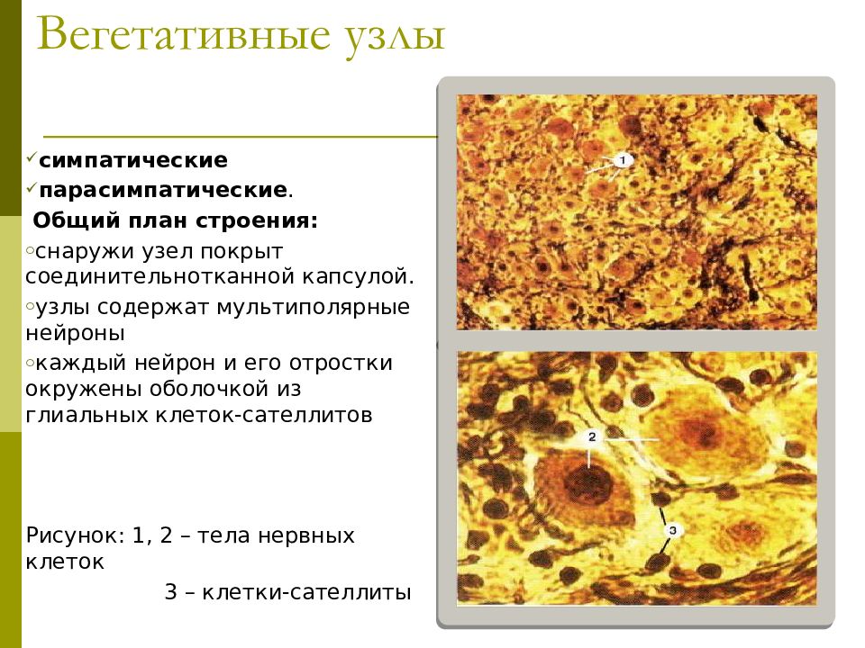 вегетативный ганглий гистология. симпатический ганглий гистология. вегетативный нервный узел гистология.