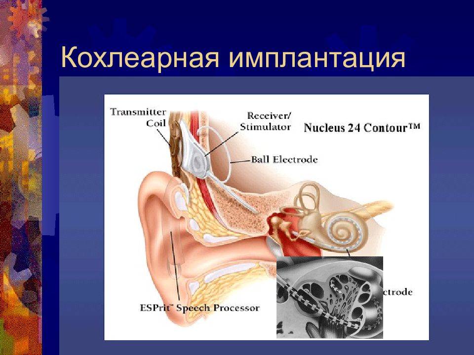 Болезнь внутреннего уха. Болезни внутреннего уха. Внутреннее ухо заболевания. Инфекции внутреннего уха. Нарушение внутреннего уха.