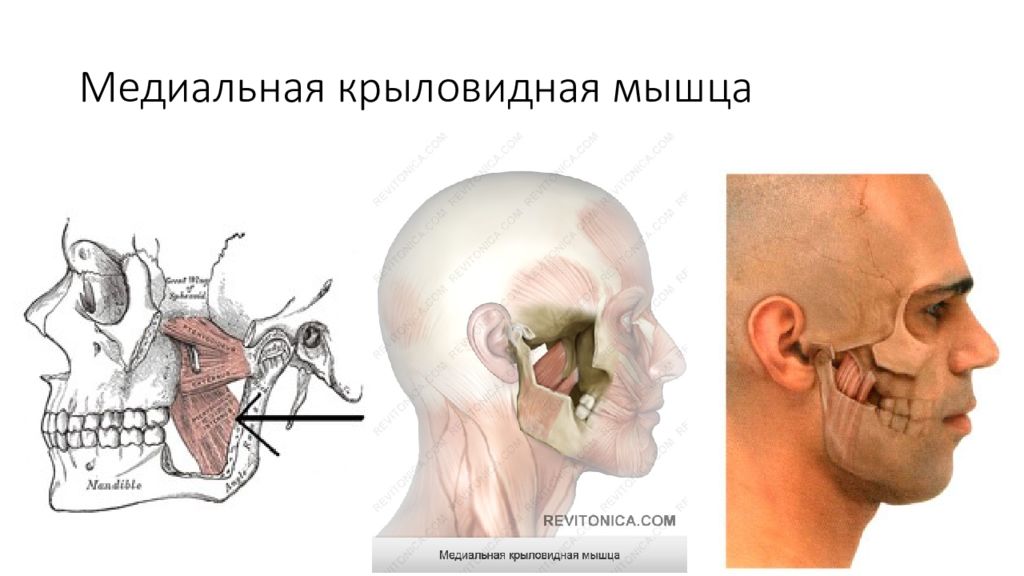 Латеральная крыловидная мышца. Медтальгл коыдовидная мышца. Медиально кыловидная мышца. Детальная крыловидная мышца. Мелиально кралоаидная мвшца.