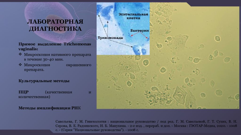 Трихомониаз диагностика