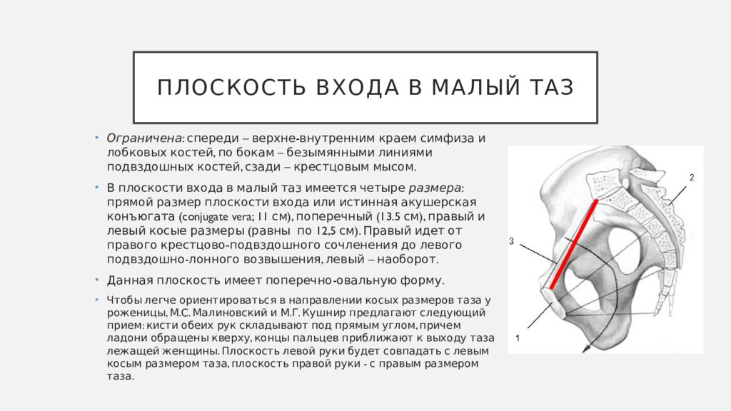 Плоскость узкой части таза. Плоскость входа в малый таз. Плоскость входа в малый таз ограничена. Плоскости малого таза. Плоскость выхода малого таза.