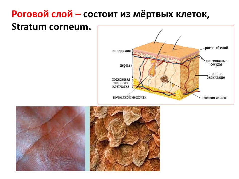 Роговая кожа. Роговой слой кожи человека. Роговые чешуйки эпидермиса. Строение рогового слоя кожи. Роговой слой эпидермиса кожи.