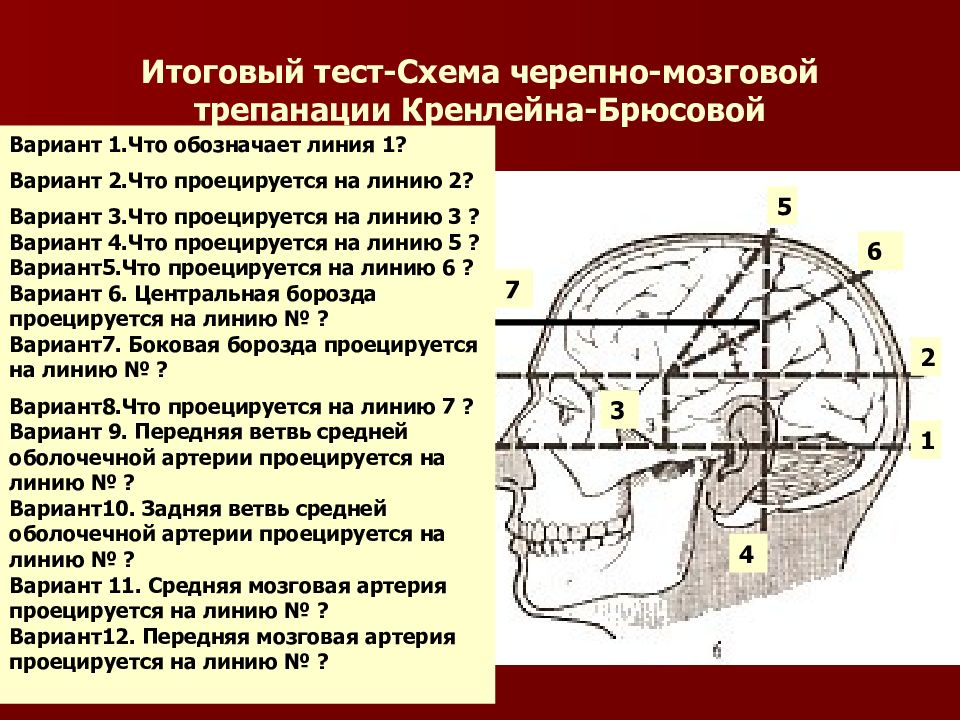 Проекция средней менингеальной артерии по схеме кренлейна брюсовой