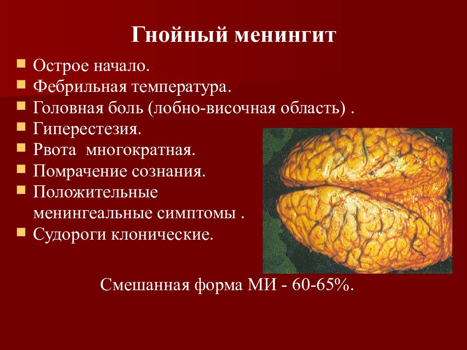 Клиническая картина менингита