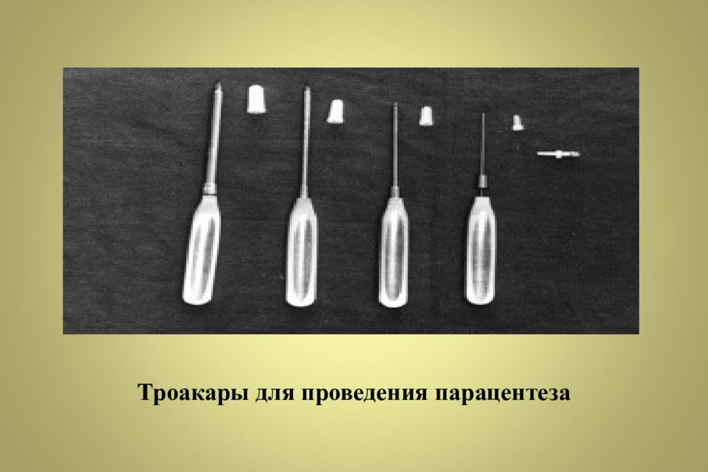 Троакар лапароцентез. Троакар для лапароцентеза. Троакар для парацентеза