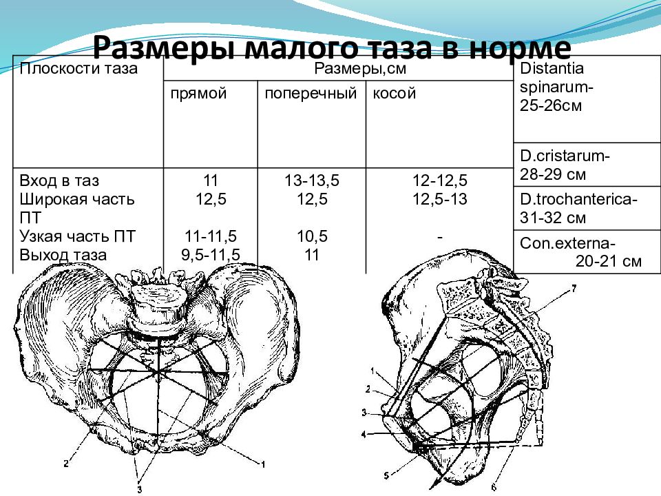 Размеры плоскостей малого таза. Размеры малого таза в акушерстве. Размеры плоскости входа в малый таз. Размеры плоскости выхода в малый таз. Прямой размер плоскости входа в малый таз.