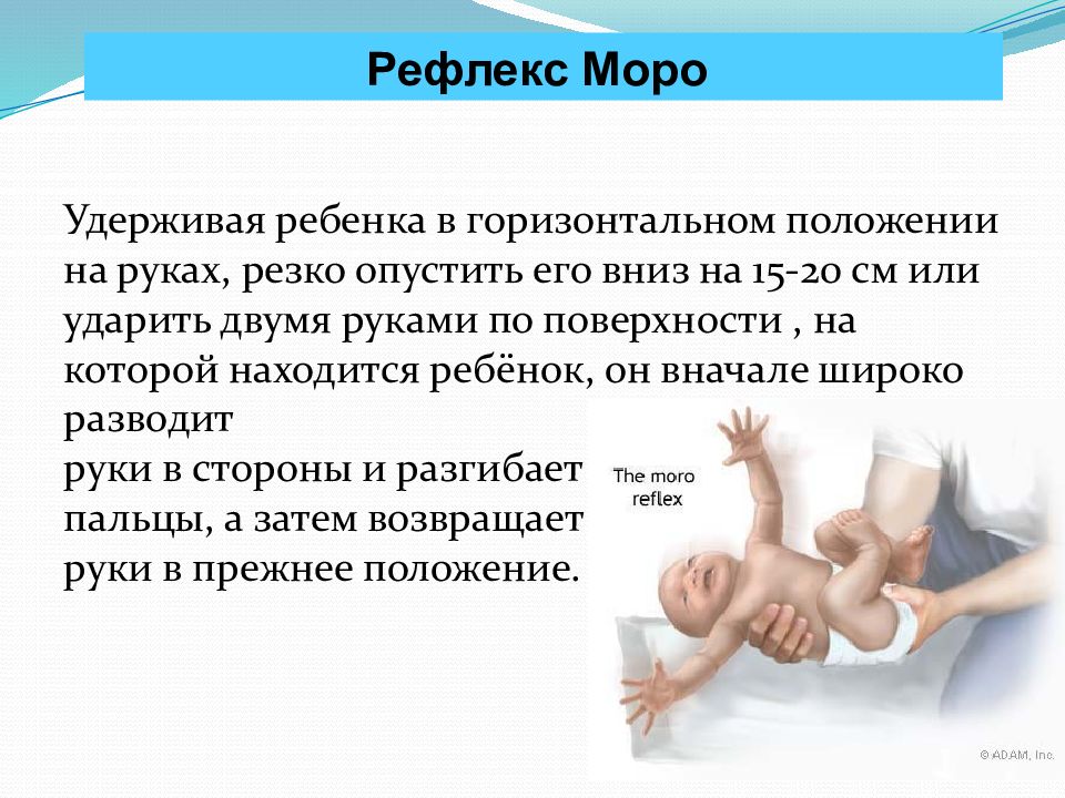 Рефлекс моро что это. Рефлекс Моро. Физиология периода новорожденности. Физиологический послеродовый период. Рефлексы периода новорожденности.