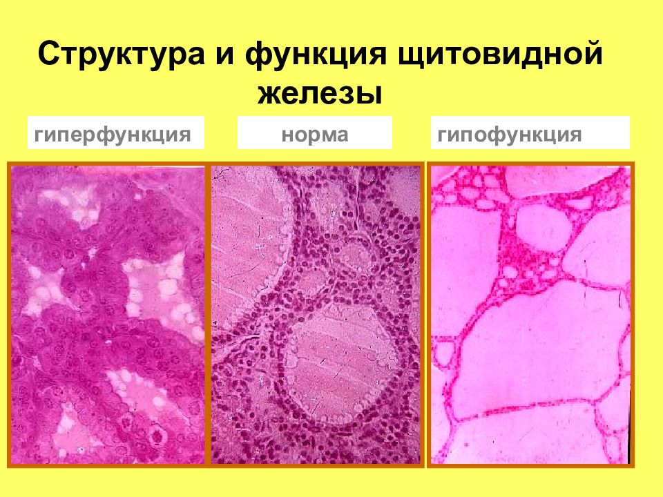 Щитовидная железа гистология рисунок