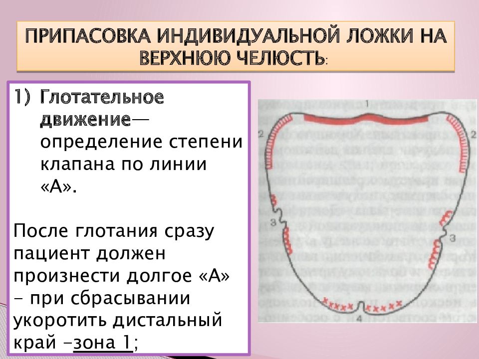 Индивидуальные ложки в ортопедической стоматологии презентация