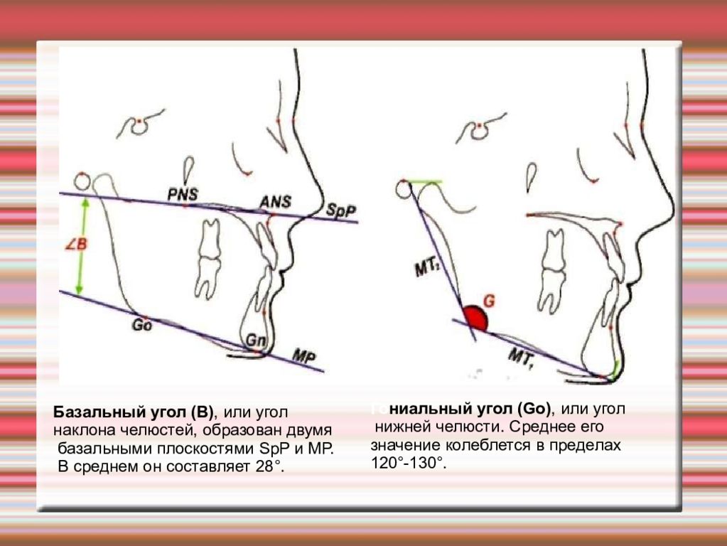 Угол spp mp. Гониальный угол ТРГ. Базальный угол на ТРГ. Базальный угол ортодонтия. Углы в ортодонтии.