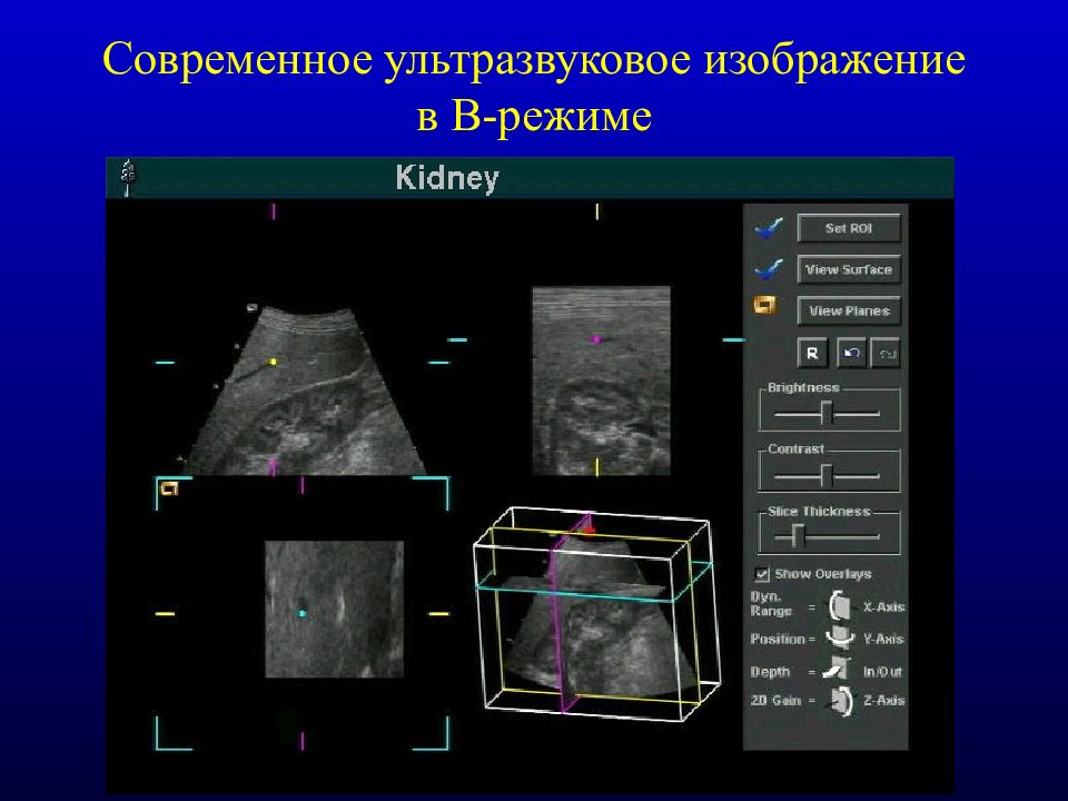 Основы ультразвуковой диагностики презентация