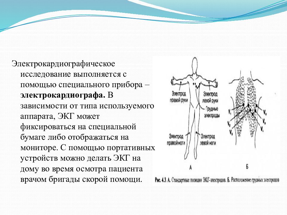 Презентация экг для студентов