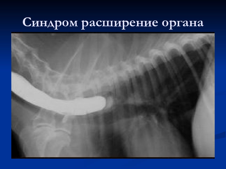 Расширение органа. Синдром расширения пищеварительного канала. Синдром локального расширения пищеварительного канала. Синдром расширения пищеварительного канала рентген.