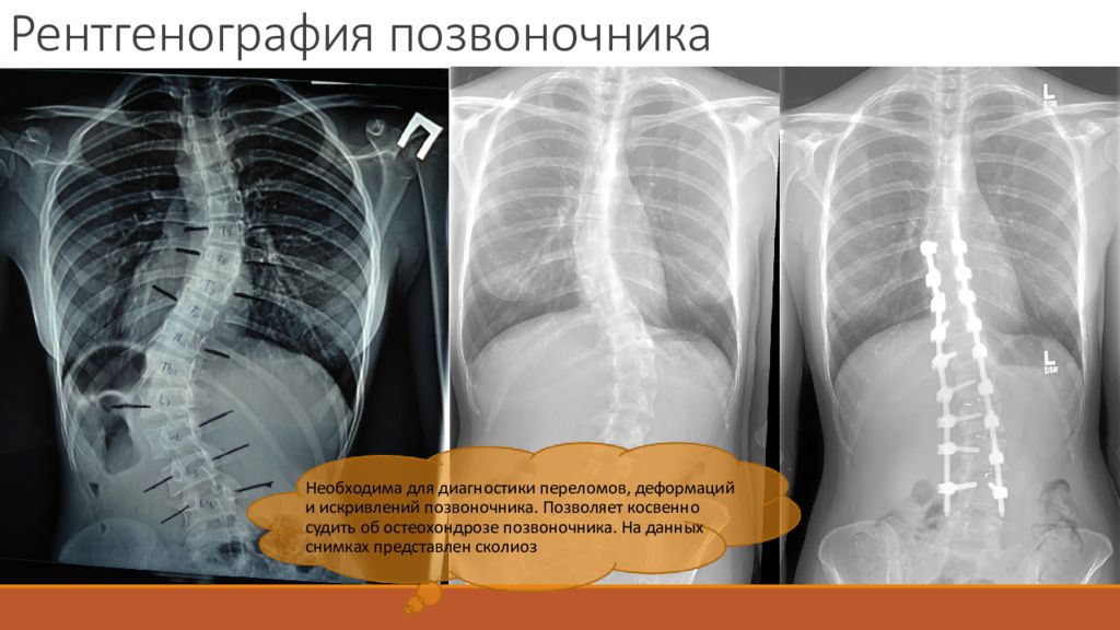 Рентген Позвоночника Цена