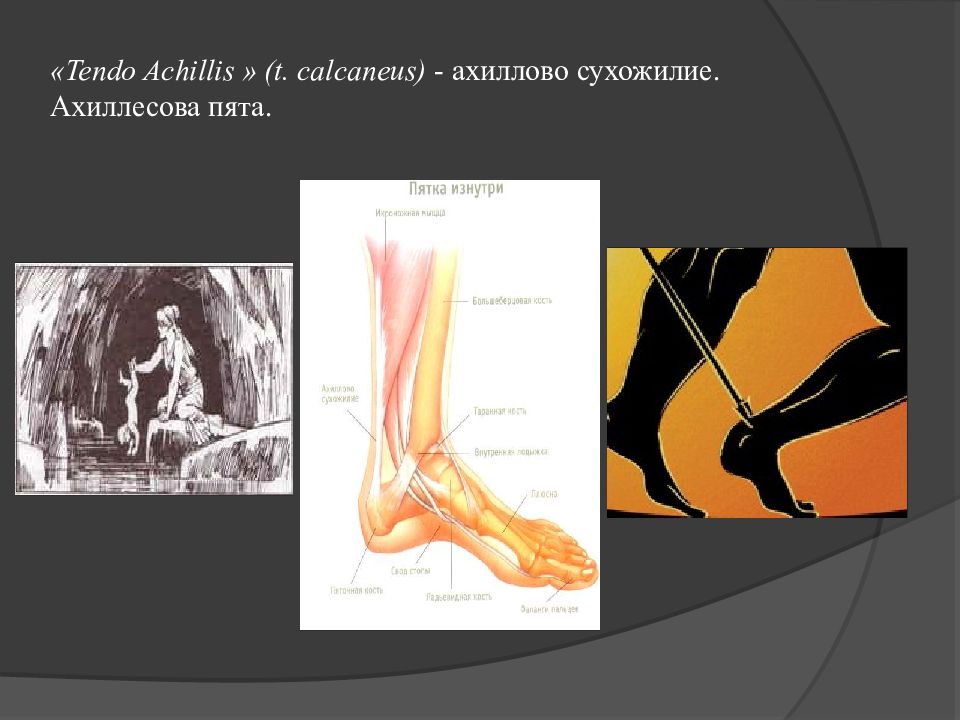 Ахиллесово столпотворение. Ахиллесова пята в анатомии человека. Ахиллесова пята болезнь. Ахиллесова пята что это значит. Ахиллесова пята где.