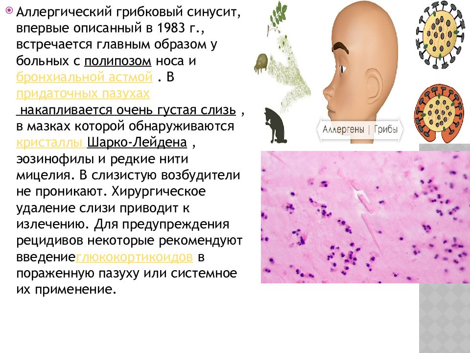 Острые и хронические синуситы презентация