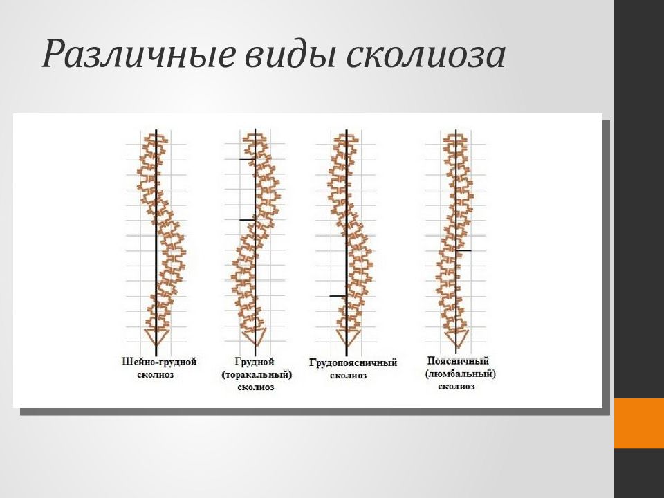 Виды позвоночника