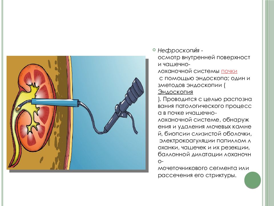 Инструментальные методы диагностики в урологии презентация